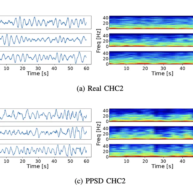 PPSD GAN: PPSD-informed Generative Model for Ambient Seismic Noise Synthesizing